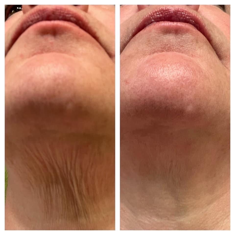 Neck Sculpt + Lift | Gua Sha Tool + Cream