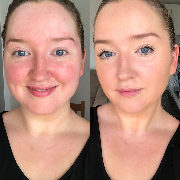 Antes e Depois Base