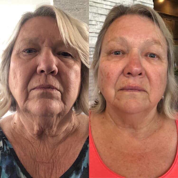 Featured customer