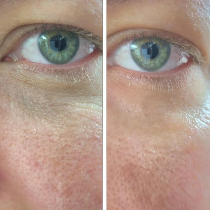 Renewal Eye Cream - PDRN + Volufiline