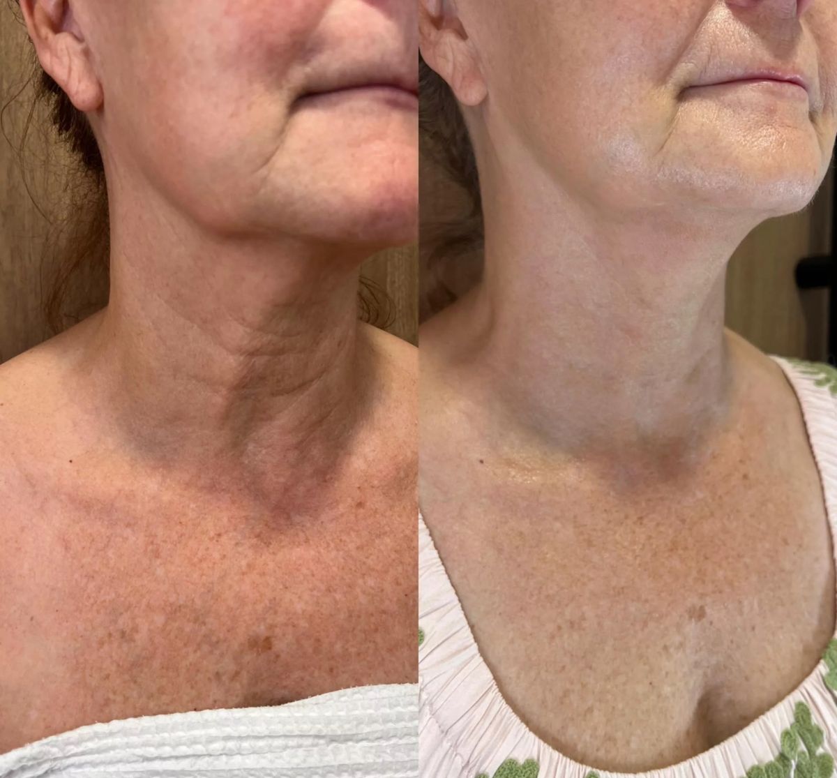 Neck Sculpt + Lift | Gua Sha Tool + Cream