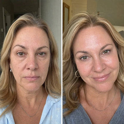 The Complete Anti-Wrinkle System