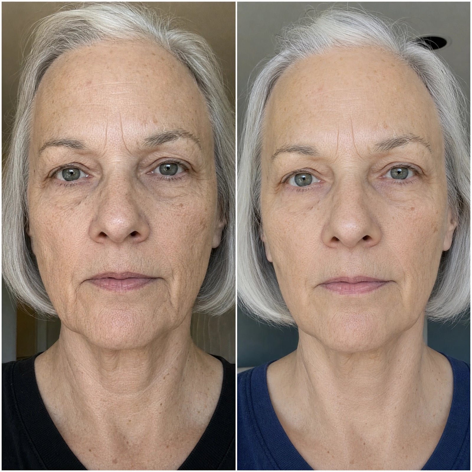 Woman 60+ applying the Ampoule across her forehead with her fingertips