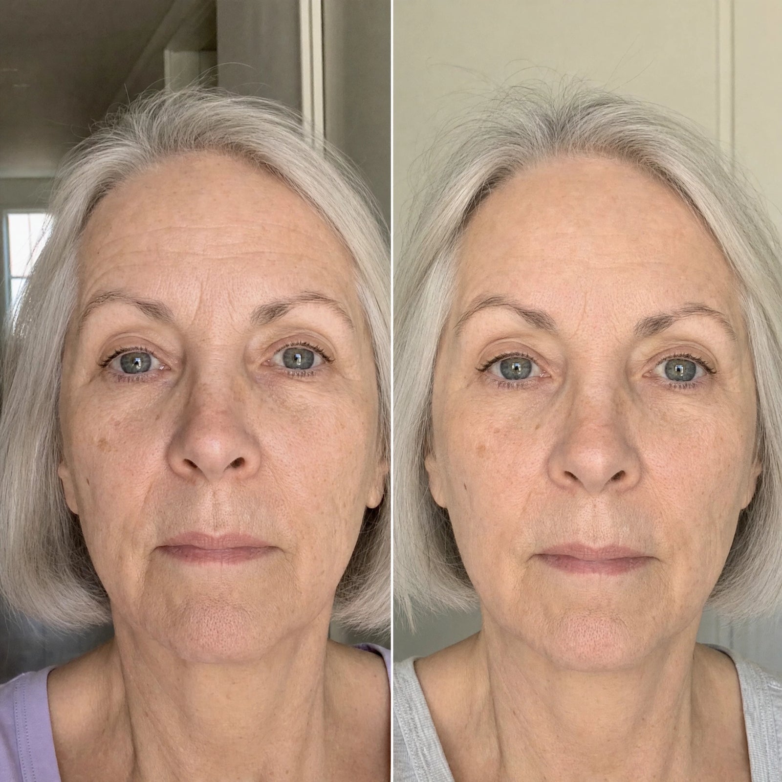 Close-up of a woman 60+ with horizontal forehead lines still visible when her face is still