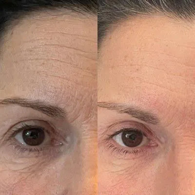 Renewal Eye Cream - PDRN + Volufiline